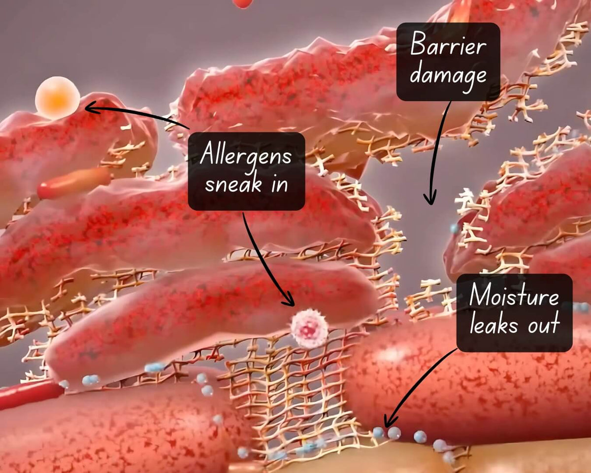 Gut barrier